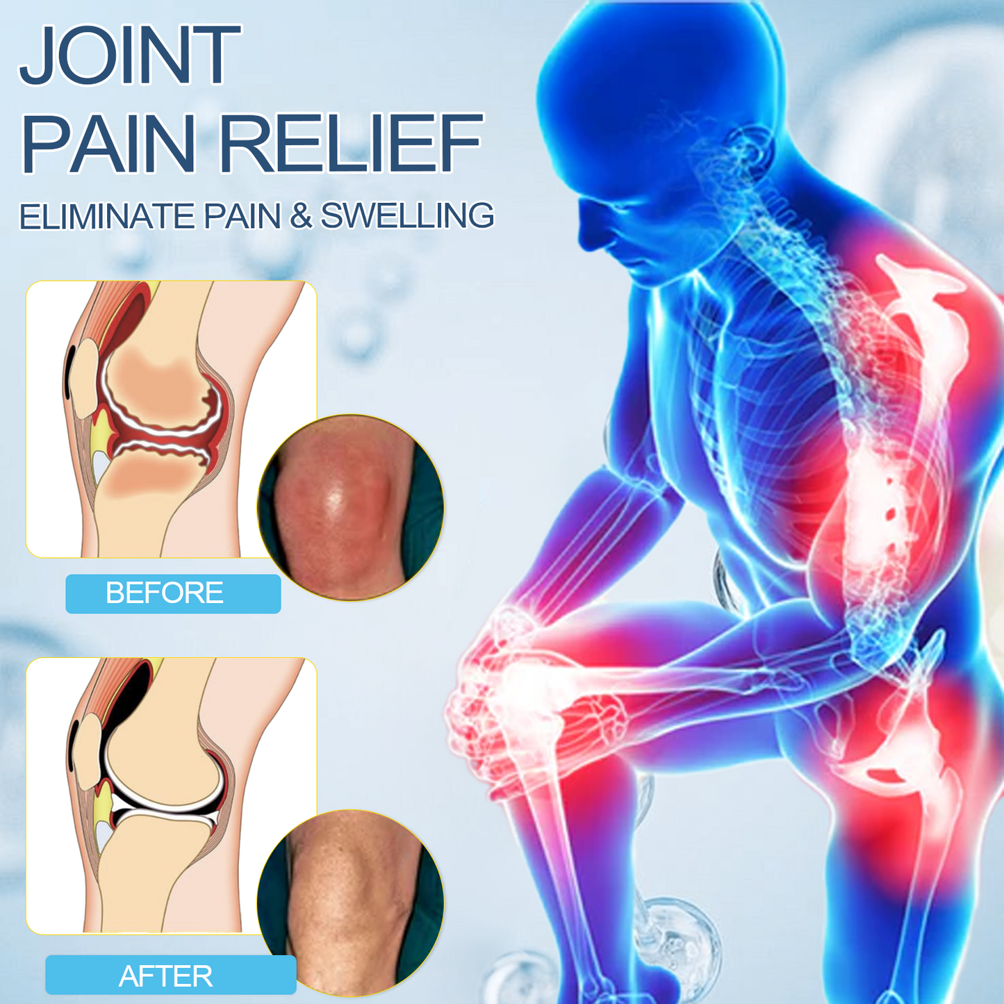đOnly 5 units left with an extra 30% off! đĽHealth experts recommend purchasing 3-4 units to prevent and address moderate to severe arthritis symptoms. Don't miss outânext chance is next year! â°Grab yours now!