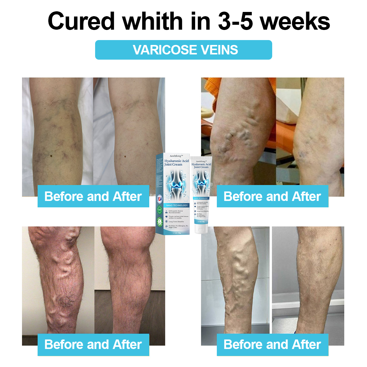 đOnly 5 units left with an extra 30% off! đĽHealth experts recommend purchasing 3-4 units to prevent and address moderate to severe arthritis symptoms. Don't miss outânext chance is next year! â°Grab yours now!