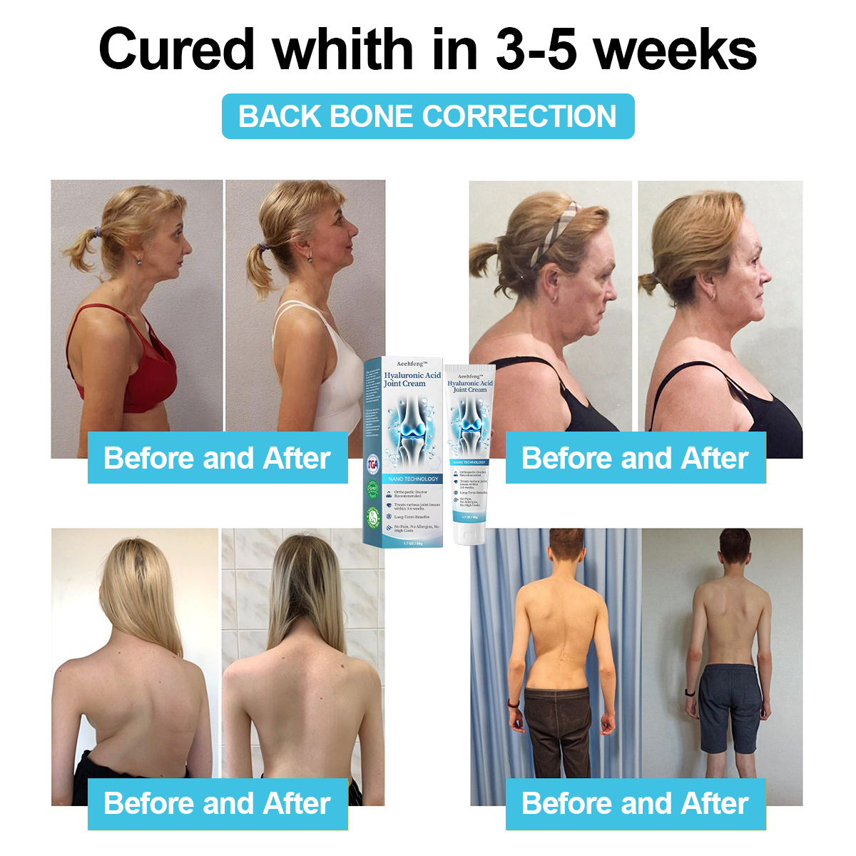 đOnly 5 units left with an extra 30% off! đĽHealth experts recommend purchasing 3-4 units to prevent and address moderate to severe arthritis symptoms. Don't miss outânext chance is next year! â°Grab yours now!