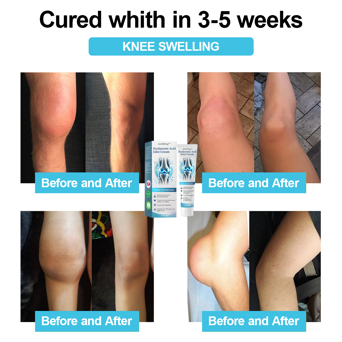 đOnly 5 units left with an extra 30% off! đĽHealth experts recommend purchasing 3-4 units to prevent and address moderate to severe arthritis symptoms. Don't miss outânext chance is next year! â°Grab yours now!