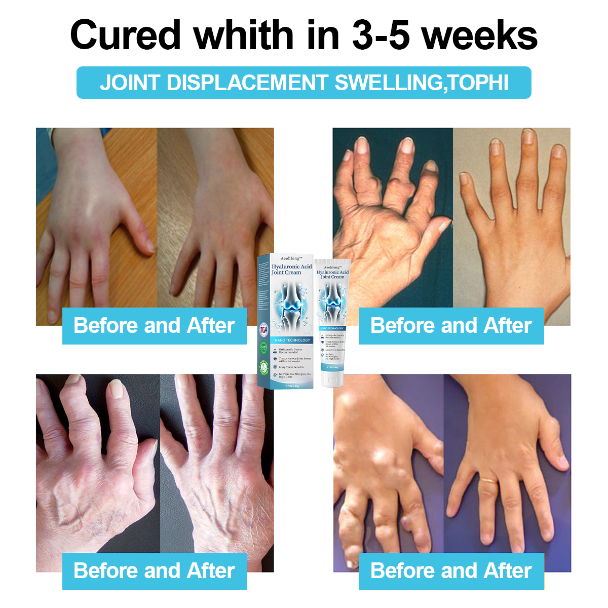 đOnly 5 units left with an extra 30% off! đĽHealth experts recommend purchasing 3-4 units to prevent and address moderate to severe arthritis symptoms. Don't miss outânext chance is next year! â°Grab yours now!