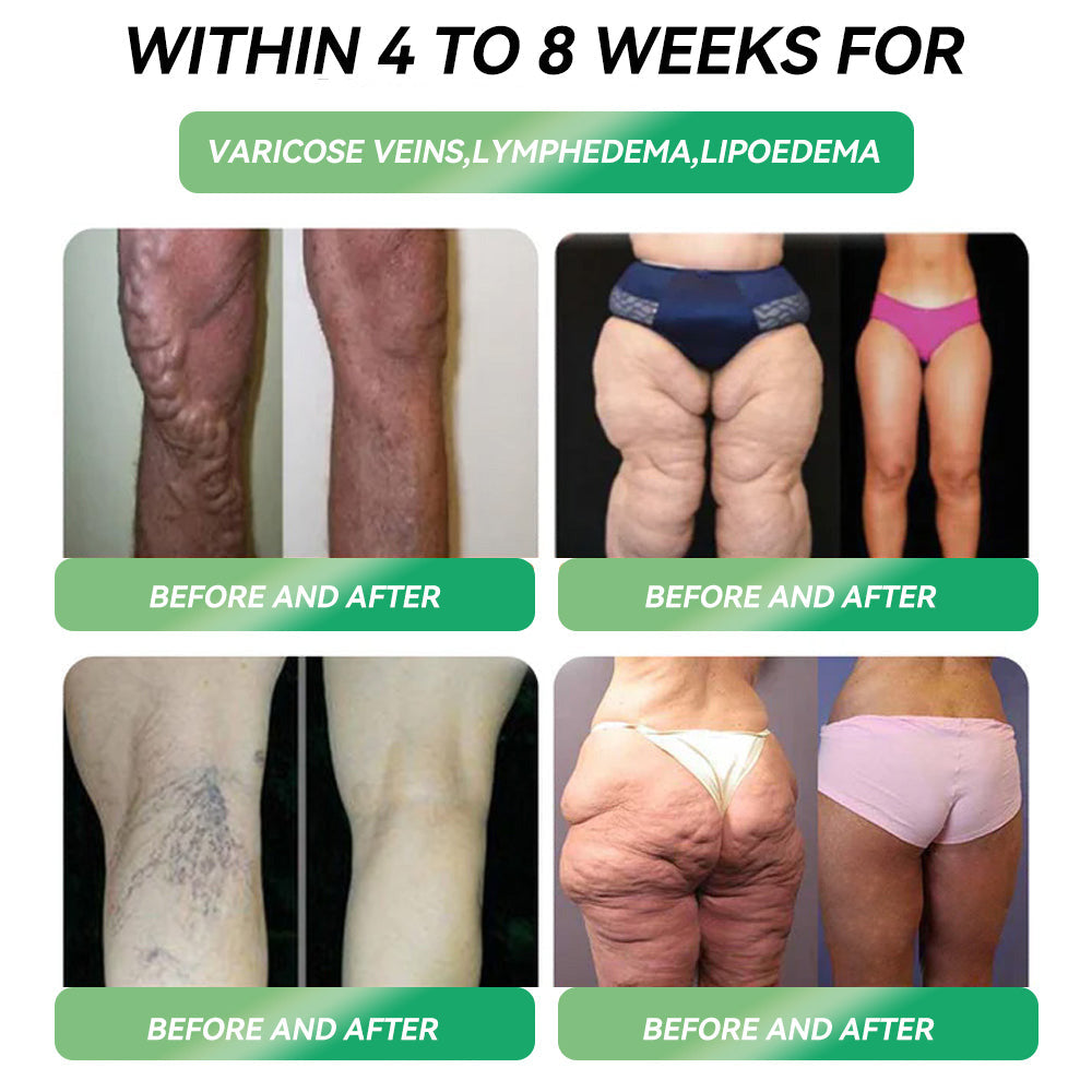 Only 10 boxes left! ⏰ Grab an exclusive 30% discount now! Endocrinologists recommend 4 to 6 boxes to stabilise weight loss and prevent rebound. Last chance before the year ends! Don’t wait any longer!